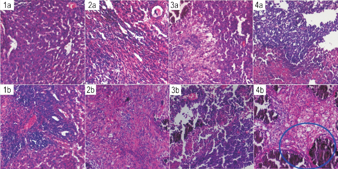 Histological sections of N1S1 tumour tissue from animals administered with (1a-4a) cold Biorex 70 microspheres for 1, 2, 5 and 7 days, respectively and (1b-4b) 90Y-labelled Biorex 70 microspheres for the same time intervals (Magnification 10x). Area circled in blue shows regions of greater necrotic damage in the tumour tissue.